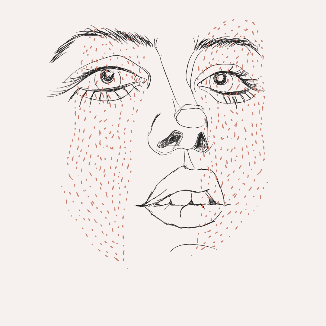 woman's face with red dashed freckles, set against a white background